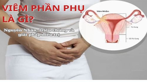 Viêm phần phụ: Nguyên Nhân – triệu chứng – giải pháp điều trị