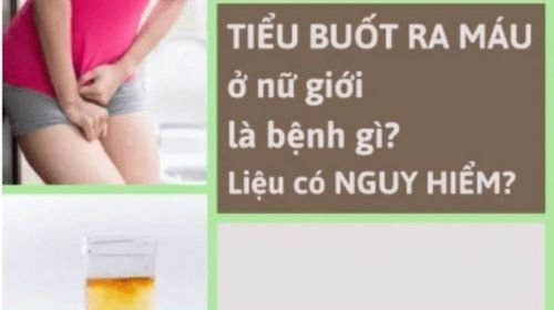 Đi tiểu bị đau cảnh báo bệnh gì? Nguyên nhân và cách chữa