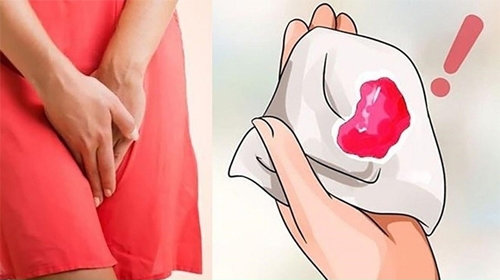 Cảnh báo: Ra máu vùng kín có thể là dấu hiệu của điều gì nguy hiểm