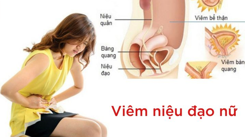 Đau niệu đạo nữ có phải bệnh nguy hiểm không?