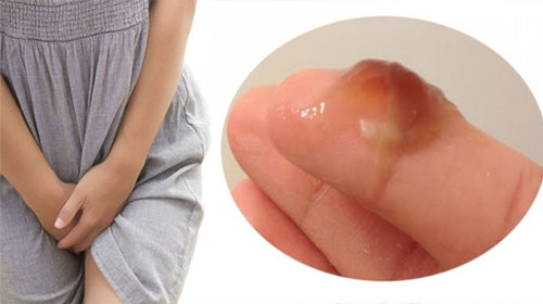 Ra Nhiều Khí Hư Màu Nâu Đỏ, Vón Cục Là Dấu Hiệu Của Tình Trạng Bệnh Nguy Hiểm Gì?