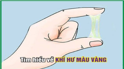 Khí hư màu trắng sữa: Dấu hiệu đáng lo ngại bạn cần chú ý ngay!