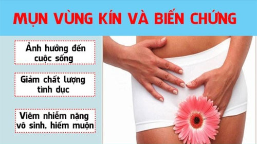 Mụn rộp vùng kín: Những điều chị em cần lưu ý để tránh nguy cơ lây nhiễm