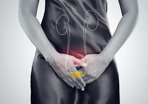 Cách chữa viêm đường tiết niệu tránh những biến chứng nguy hiểm