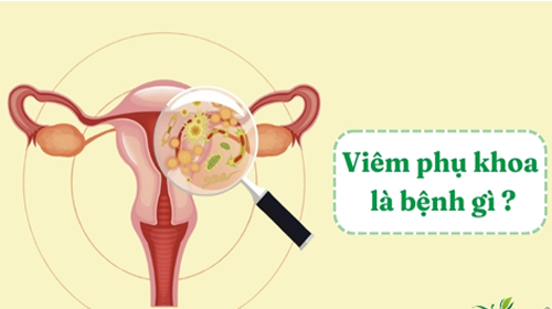 Viêm ngứa phụ khoa và những điều chị em cần biết