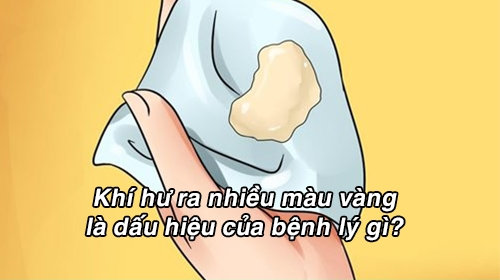 Khí hư ra nhiều màu vàng là dấu hiệu của bệnh lý gì?