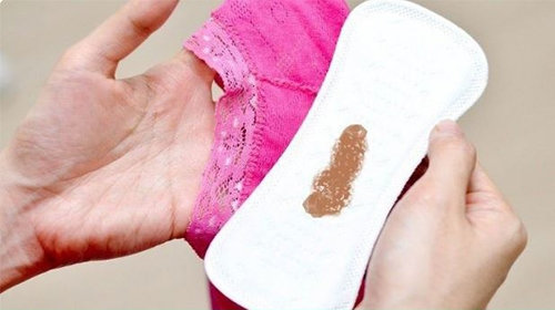 Ra máu nâu âm đạo bất thường – Dấu hiệu cảnh báo bệnh lý nguy hiểm