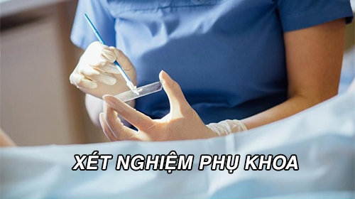 Xét nghiệm phụ khoa bao gồm những gì? Địa chỉ xét nghiệm uy tín