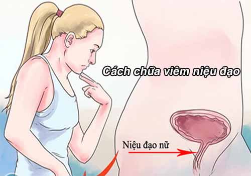 Tư vấn phương pháp chữa viêm niệu đạo ở nữ giới hiệu quả