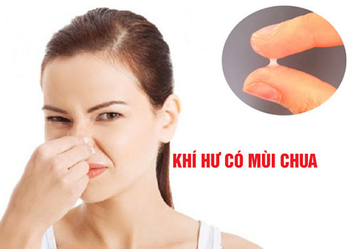 Khí hư có mùi chua cảnh báo bệnh lý nào cho chị em?