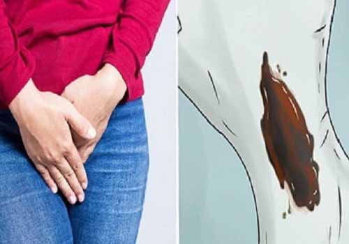 Bác sĩ hướng dẫn cách khắc phục khí hư màu đen hiệu quả