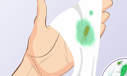 Khí hư màu xanh là dấu hiệu “cảnh báo” bệnh gì?