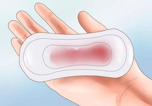 Hết kinh vẫn ra máu có nguy hiểm không? Cảnh báo bệnh gì?