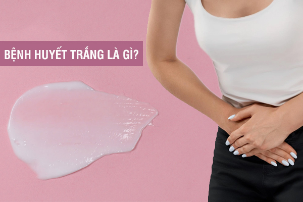 Bệnh huyết trắng và những thông tin nữ giới cần biết