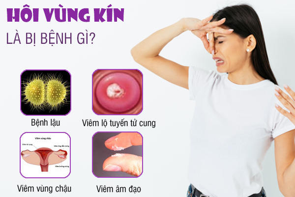 Âm đạo hôi là bình thường hay bệnh lý? Bác sĩ tư vấn