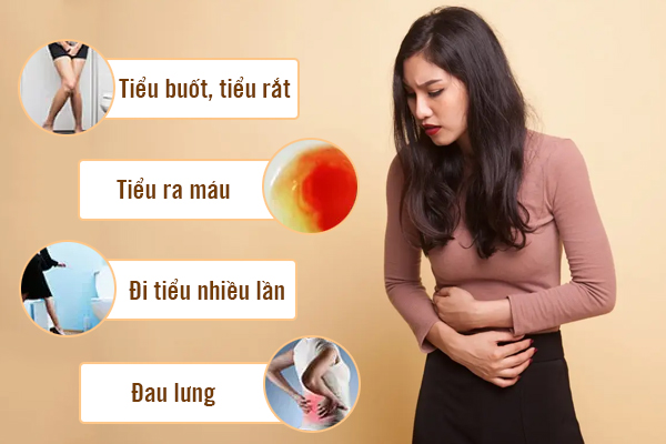 6 Dấu Hiệu Viêm Đường Tiết Niệu Nữ Không Thể Bỏ Qua