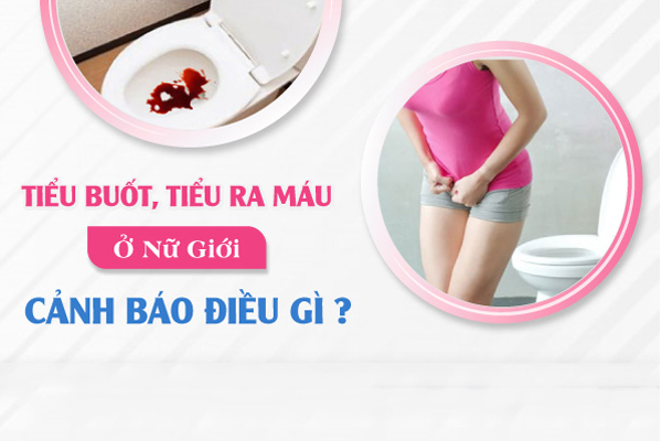 Đi tiểu ra máu ở nữ giới là bị bệnh gì? Cách chữa trị hiệu quả