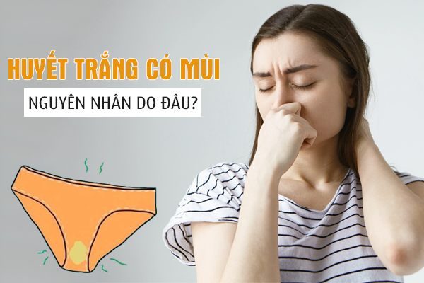 Huyết trắng có mùi: Nguyên nhân và cách xử lý an toàn