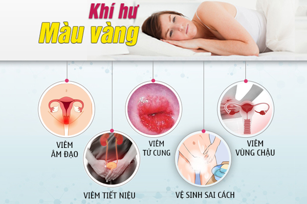 Huyết trắng màu vàng: Nguyên nhân và cách khắc phục hiệu quả