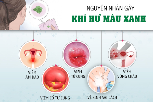 Tại sao huyết trắng màu xanh? Chuyên gia giải đáp chi tiết