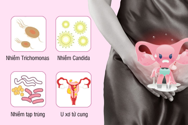 Huyết trắng ra nhiều - Dấu hiệu bình thường hay bệnh lý?