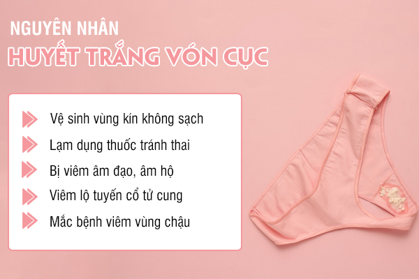 Ra huyết trắng vón cục - Dấu hiệu không nên bỏ qua