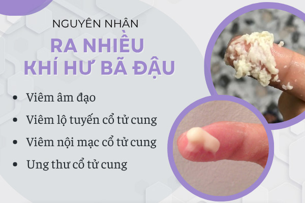 Khí hư bã đậu là bệnh gì? Khi nào cần đi khám?