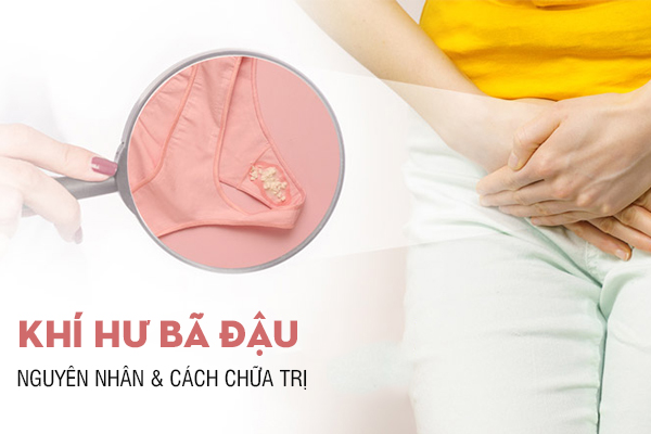 Khí hư bã đậu là bệnh gì? Khi nào cần đi khám?