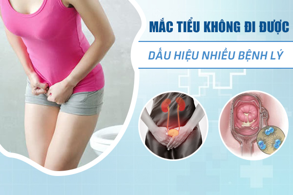 Mắc tiểu không tiểu được - Nguyên nhân do đâu?