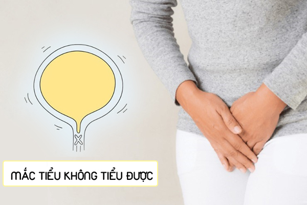 Mắc tiểu không tiểu được – Nguyên nhân do đâu?