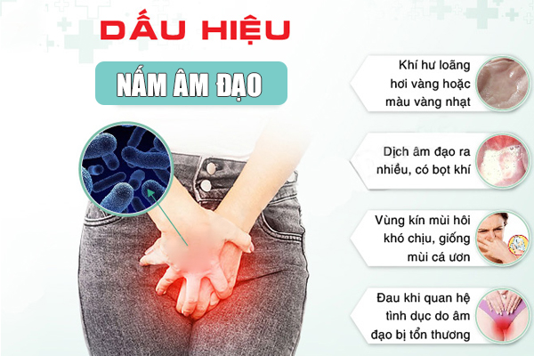 Nấm âm đạo là bệnh gì? Nguyên nhân và cách chữa trị