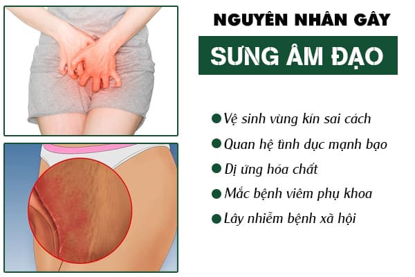 Sưng âm đạo: Nguyên nhân và biện pháp hỗ trợ điều trị