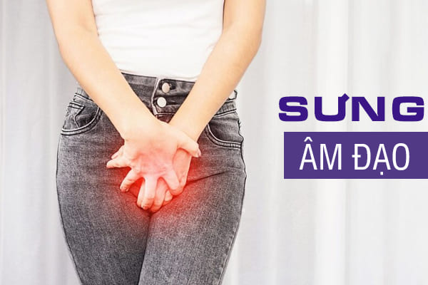 Sưng âm đạo: Nguyên nhân và biện pháp hỗ trợ điều trị