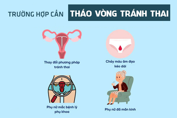 Khi nào nên tháo vòng tránh thai? Dấu hiệu cần lưu ý