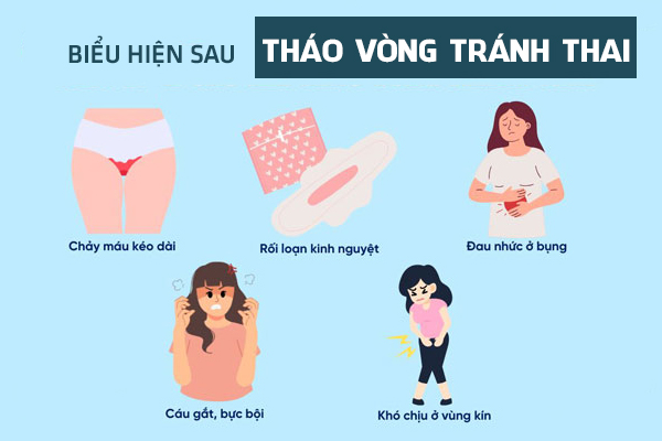 Khi nào nên tháo vòng tránh thai? Dấu hiệu cần lưu ý