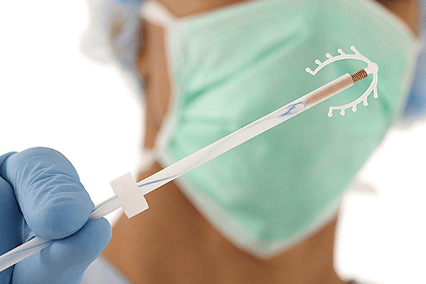 Khi nào nên tháo vòng tránh thai? Dấu hiệu cần lưu ý