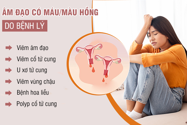 Âm đạo có máu/màu hồng - Dấu hiệu không nên xem nhẹ