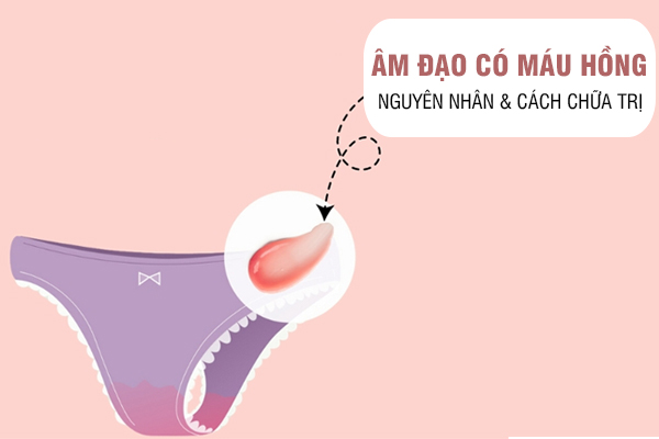 Âm đạo có máu/màu hồng – Dấu hiệu không nên xem nhẹ