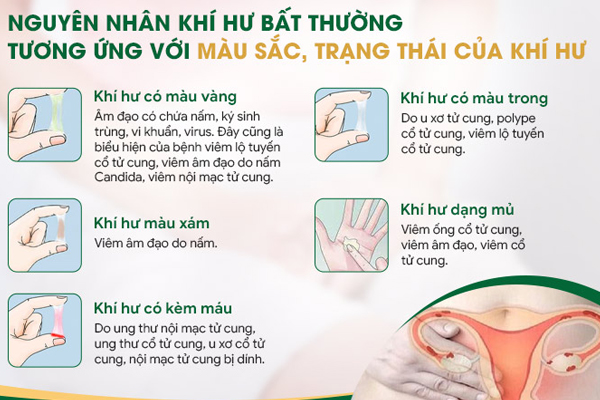 Nguyên nhân gây chảy dịch âm đạo bất thường