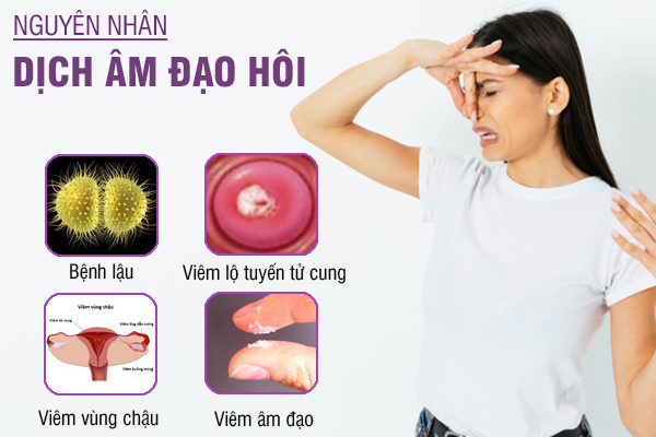 Dịch âm đạo hôi: Nguyên nhân và cách khắc phục hiệu quả