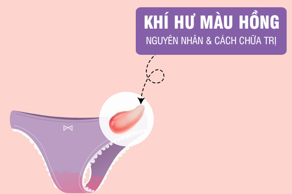Khí hư màu hồng cho biết điều gì? Có cần chữa trị?