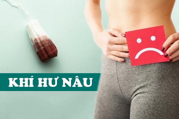 Nguyên nhân ra khí hư nâu và cách chữa hiệu quả