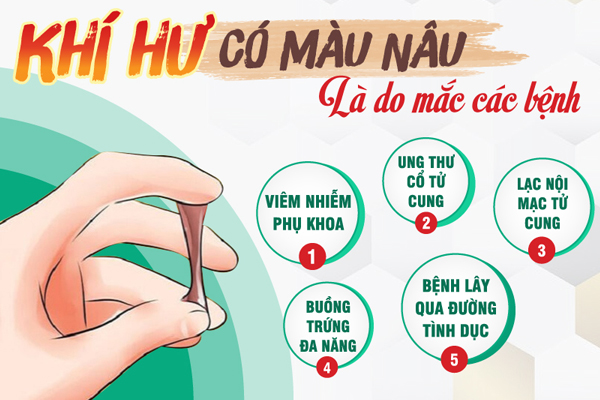 Nguyên nhân ra khí hư nâu và cách chữa hiệu quả