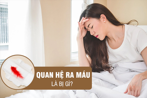 CHẢY MÁU ÂM ĐẠO KHÔNG RÕ NGUYÊN NHÂN – CẢNH BÁO BỆNH LÝ GÌ Ở NỮ